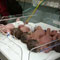 Another quintuplet birth