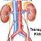 3,000 kidney patients in Uva 