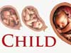 Aborting the right to life 