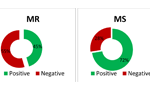 Tracking the “MR Effect” through Social Media