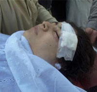 Pakistani doctors remove bullet from girl shot by Taliban